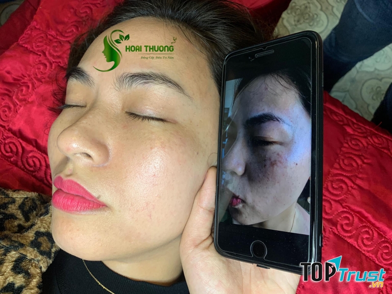 HOÀI THƯƠNG SPA