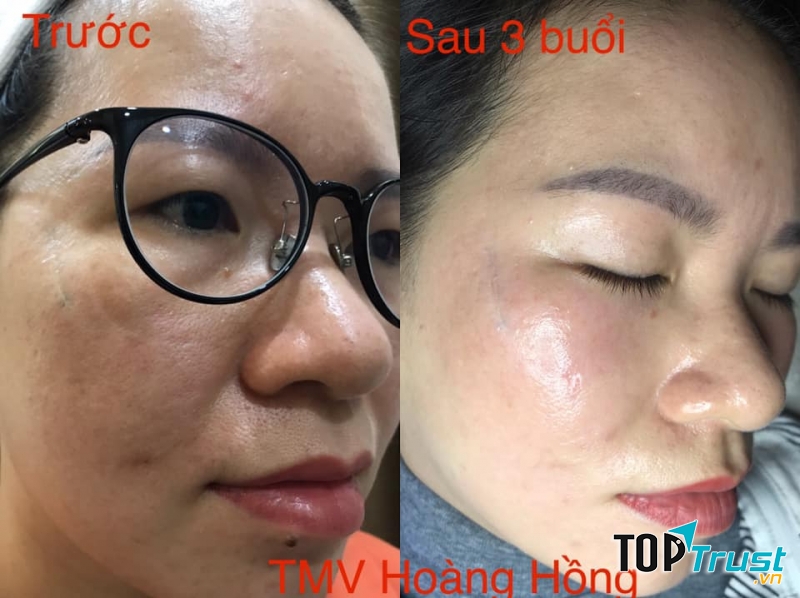 Hoàng Hồng Salon & Spa