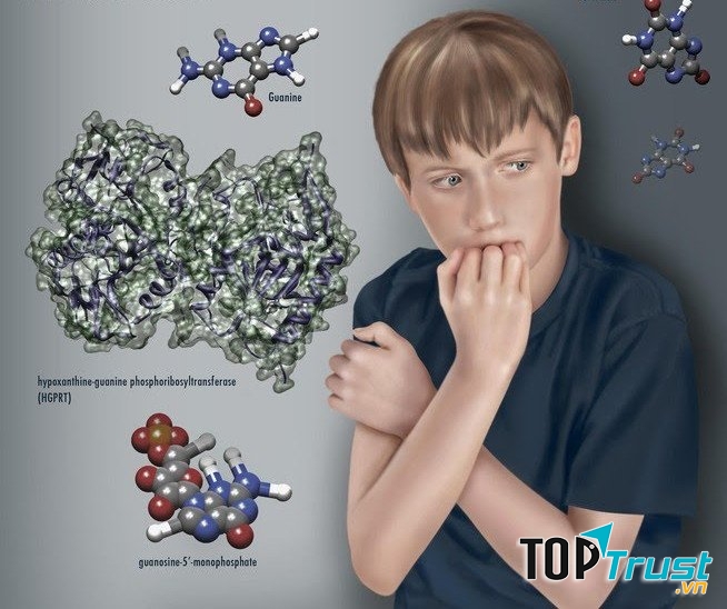 Hội chứng Lesch-Nyhan