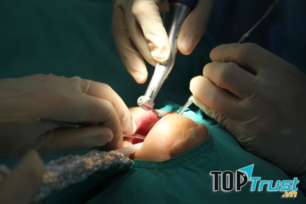 Home Dental - Nha Khoa tiêu chuẩn Đức