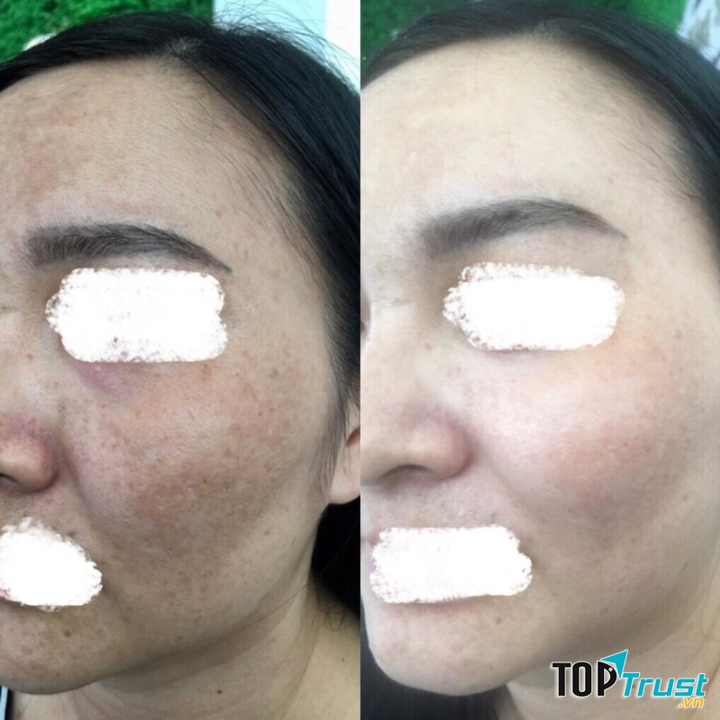 Ảnh minh họa - Nguồn Internet