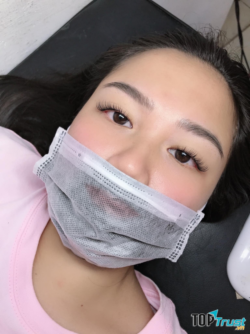 Hồng Nối Mi