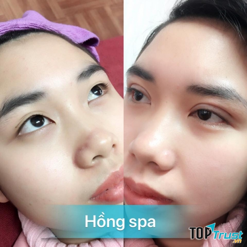 Hồng Spa