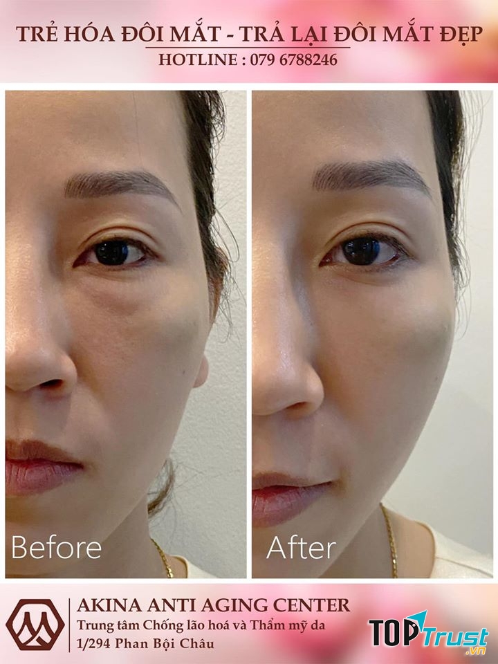 AKINA ANTI AGING Center