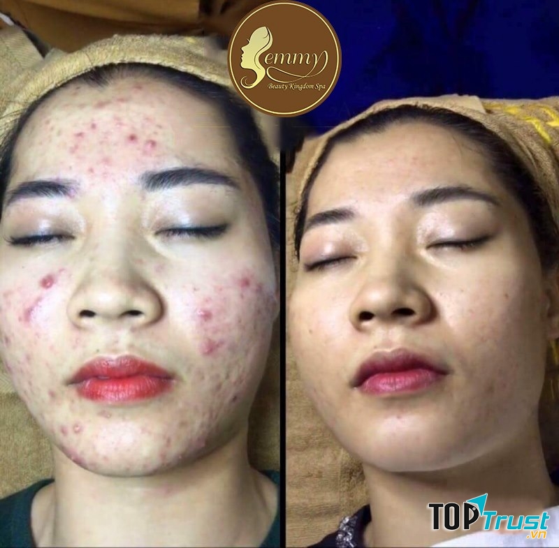 Thẩm Mỹ Quốc Tế Emmy