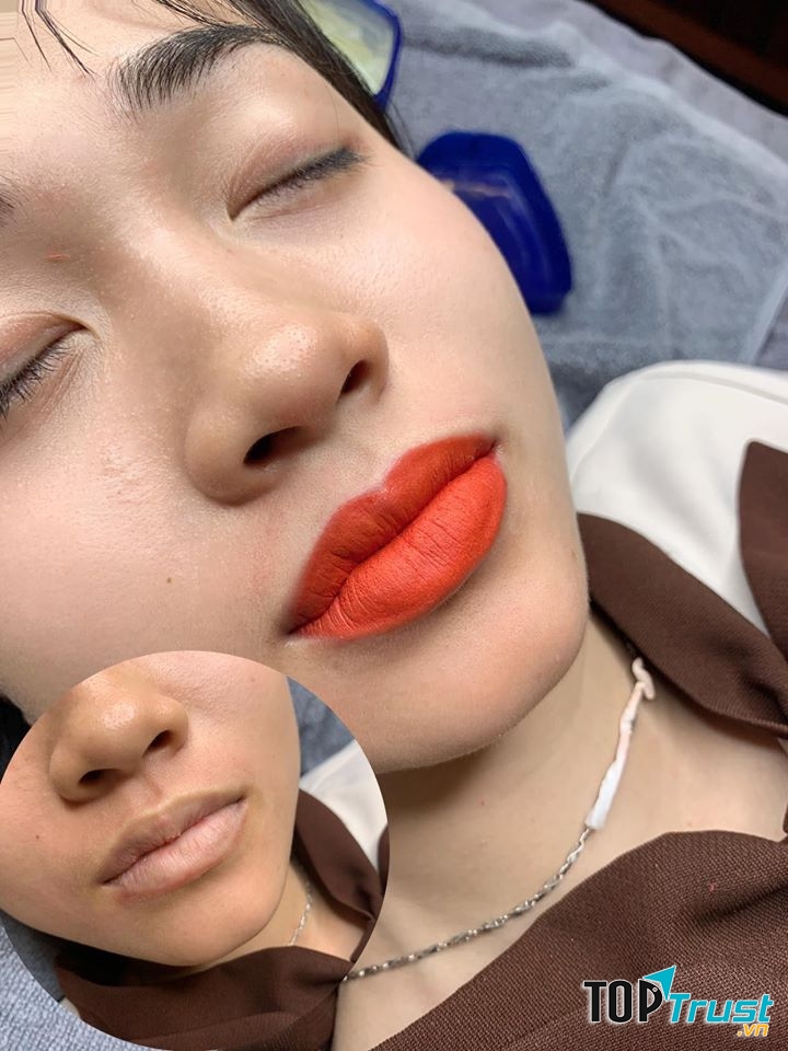 Thẩm Mỹ Quốc Tế Emmy