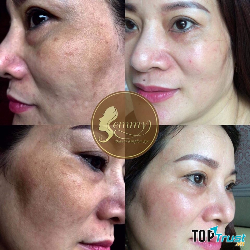 Thẩm Mỹ Emmy Huế