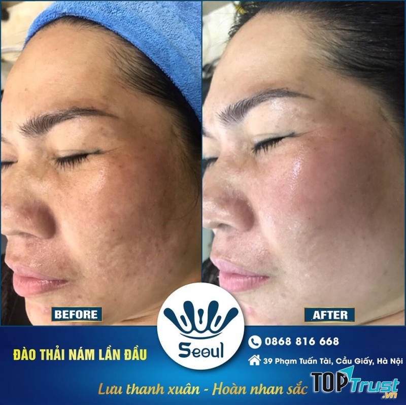 Học Viện Thẩm Mỹ Quốc tế Seoul