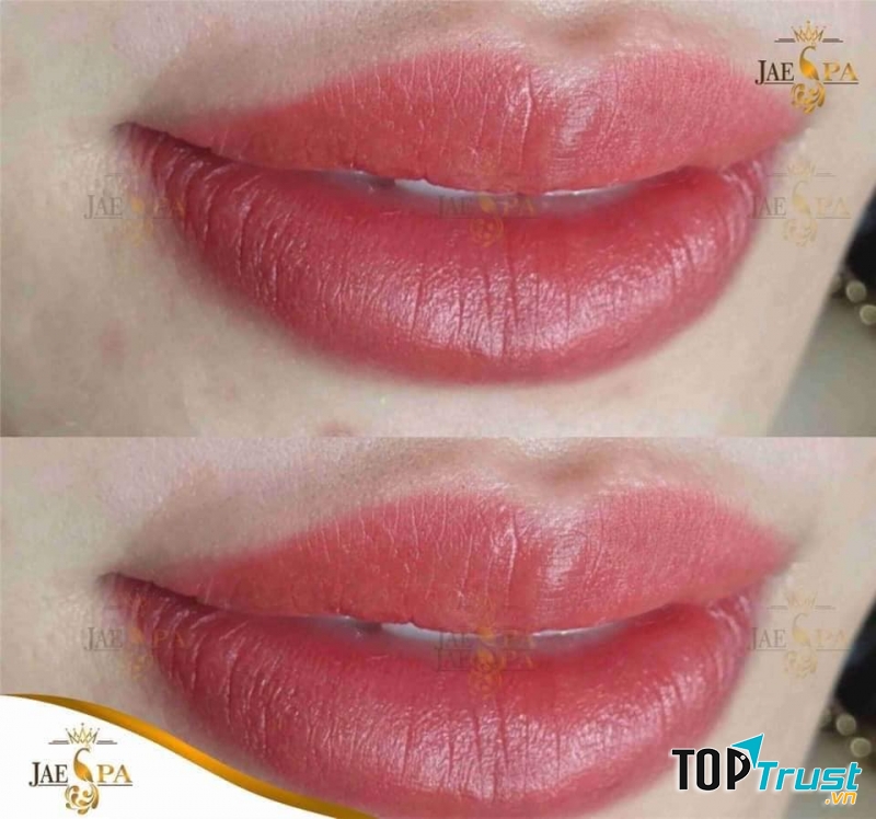 JAE SPA - Thẩm Mỹ Công Nghệ Cao