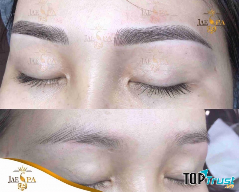 JAE SPA - Thẩm Mỹ Công Nghệ Cao