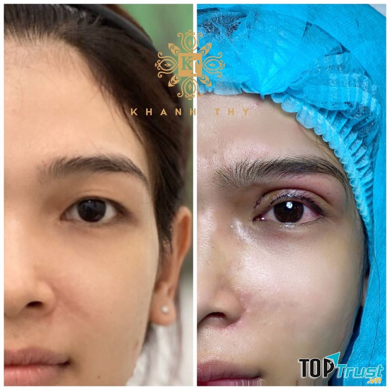 Thẩm Mỹ Viện Khánh Thy