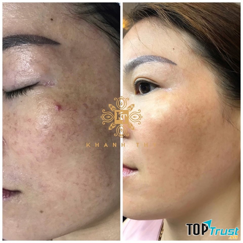 Thẩm Mỹ Viện Khánh Thy