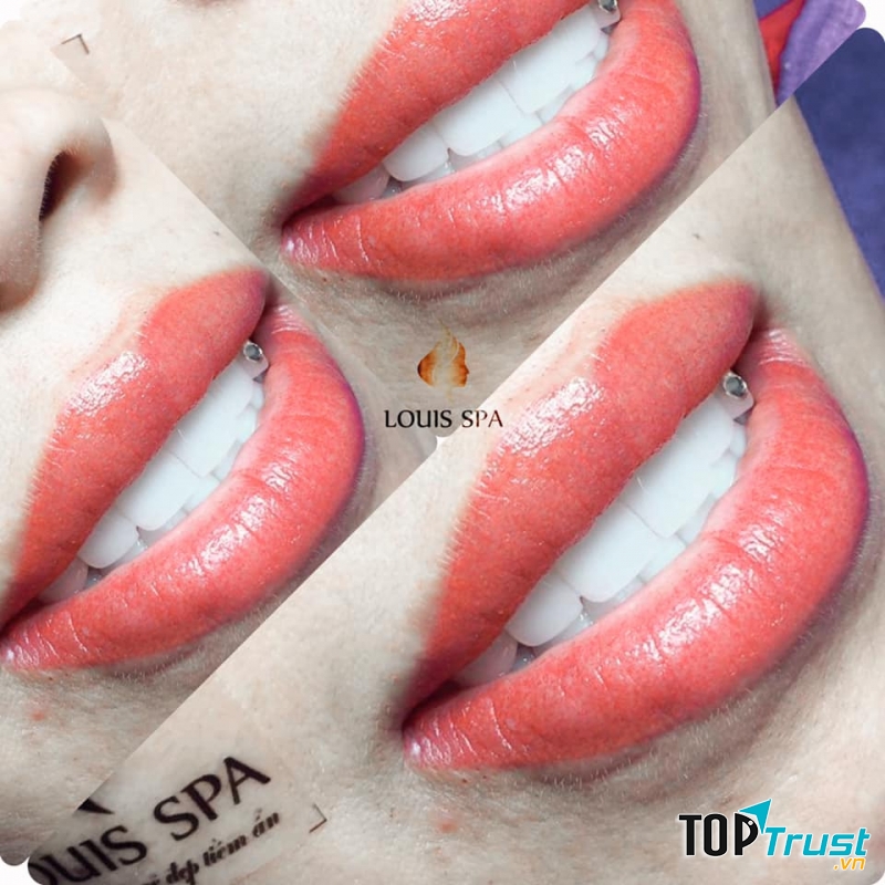 Viện Thẩm Mỹ Louis Spa