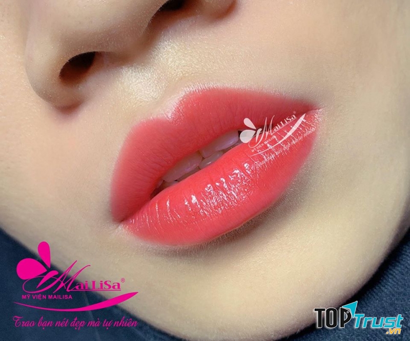 Thẩm Mỹ Viện Mailisa