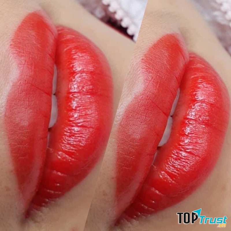 Viện Thẩm Mỹ Bảo Xinh