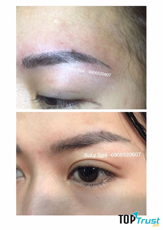 Viện Thẩm Mỹ SuLy