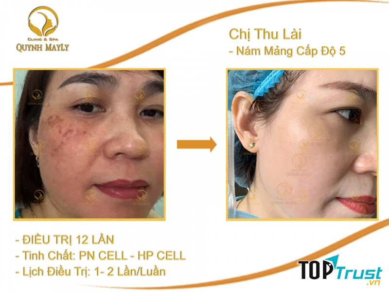 Quynh Mayly - Clinic & Spa
