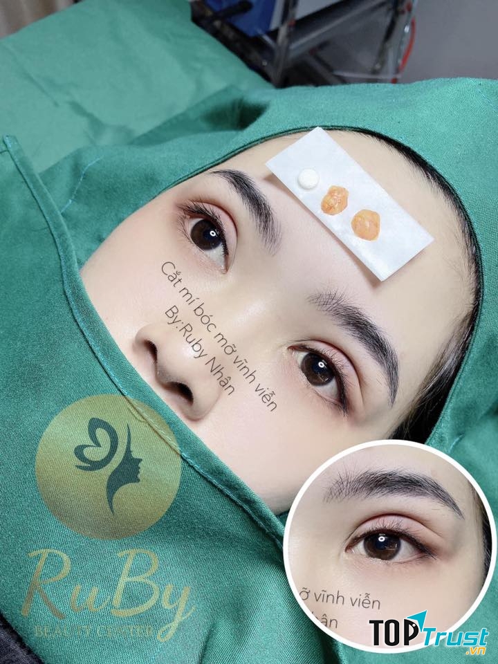 Thẩm Mỹ Quốc Tế RuBy Beauty Center