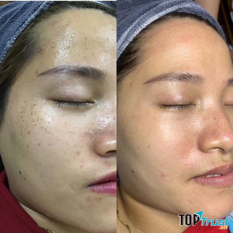 Thẩm Mỹ Viện Sài Gòn Luxury