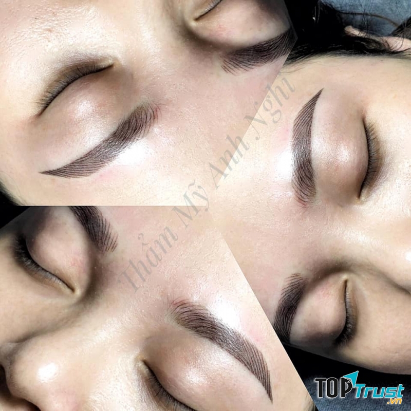 Thẩm Mỹ Anh Nghi