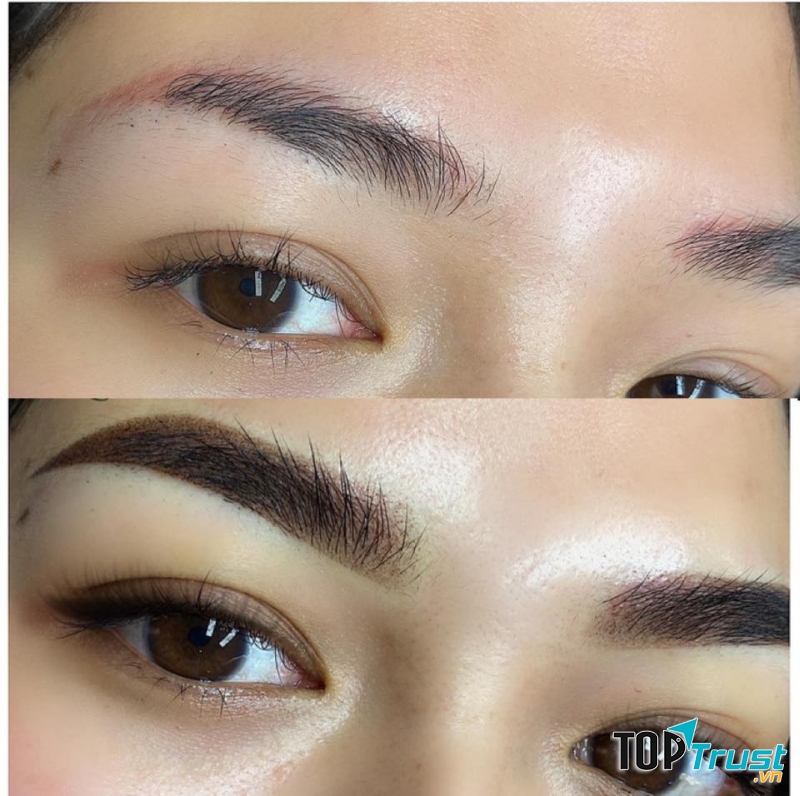 Thẩm Mỹ Anna Huỳnh