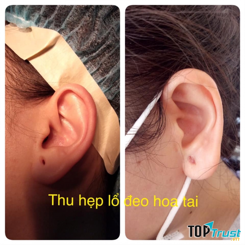 Thẩm mỹ Miss Duyên