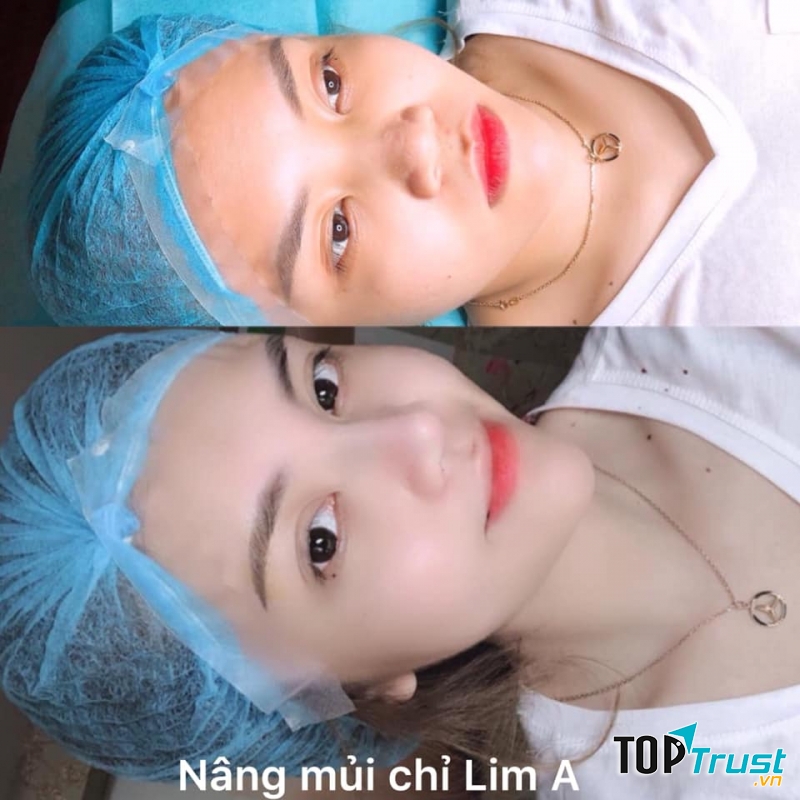 Thẩm Mỹ Quốc Tế Lim A