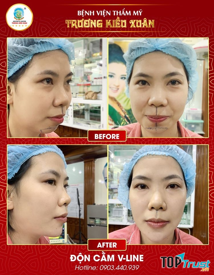 Bệnh Viện Thẩm Mỹ Trương Kiều Xuân