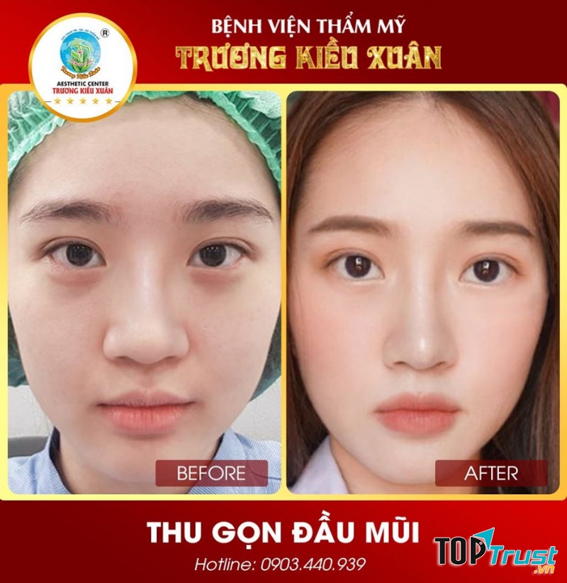 Bệnh Viện Thẩm Mỹ Trương Kiều Xuân