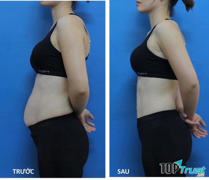 Thẩm Mỹ Viện Dorine by Thúy