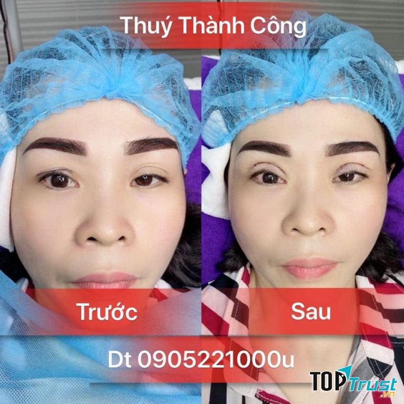 Thẩm Mỹ Viện Dorine by Thúy