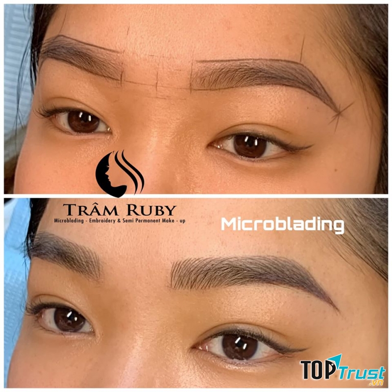 Phun Thêu Trâm Ruby