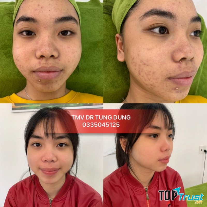 Thẩm Mỹ Viện BS Tùng Dung