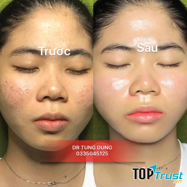 Thẩm Mỹ Viện BS Tùng Dung