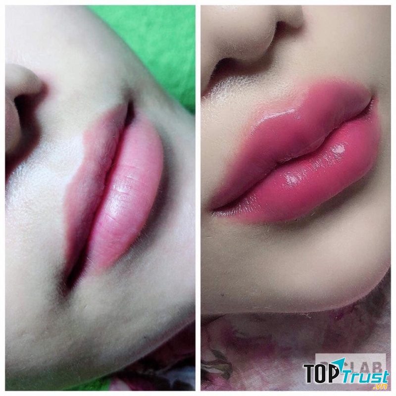 Trung Tâm Thẩm Mỹ Hoàng Gia