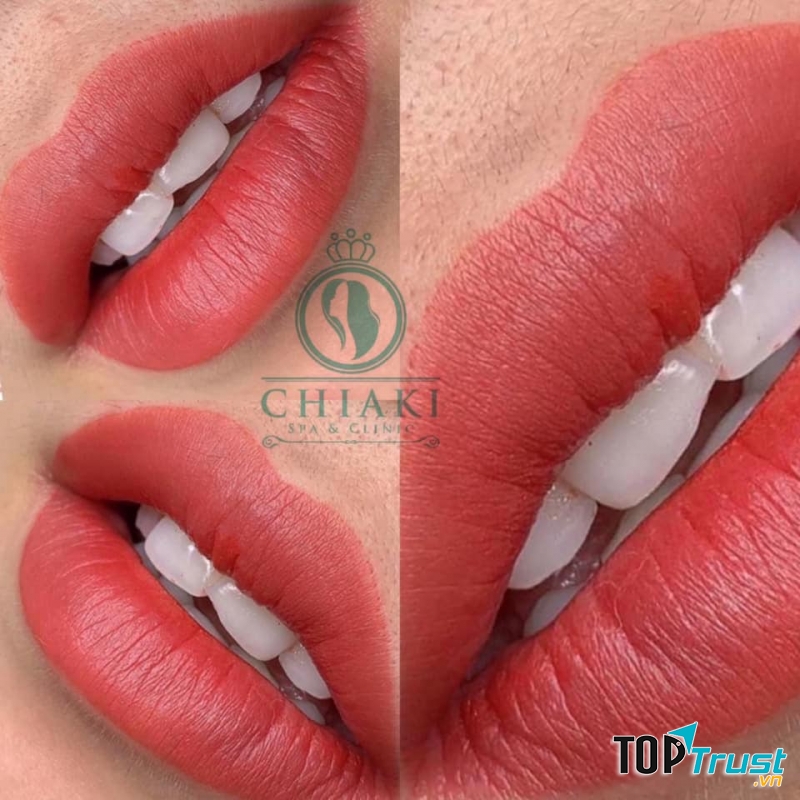 Viện Thẩm Mỹ ChiaKi
