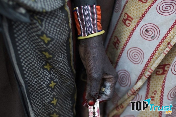 Hủ tục cắt bỏ một phần bộ phận sinh dục bé gái