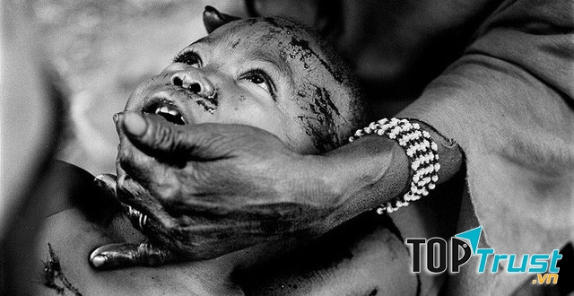 Hủ tục rạch thân ở Nigeria