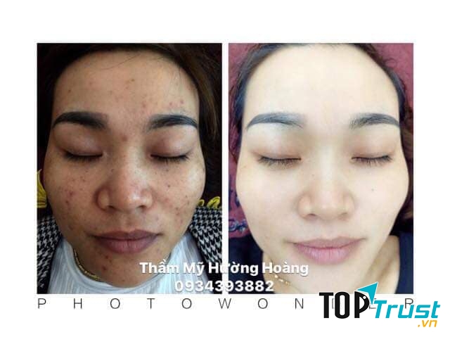 Hường Hoàng Spa