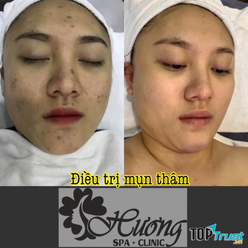 Hương Spa & Clinic