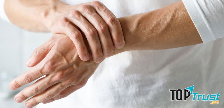 Hút thuốc lá là một trong những yếu tố làm tăng nguy cơ mắc viêm khớp dạng thấp.