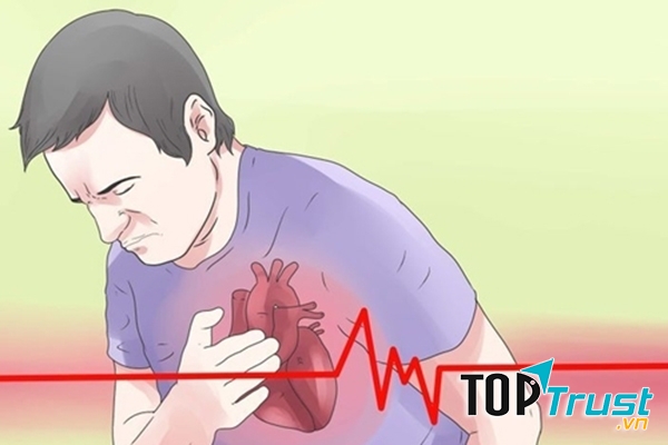 Tăng huyết áp là nguyên nhân gây tử vong hàng đầu thế giới