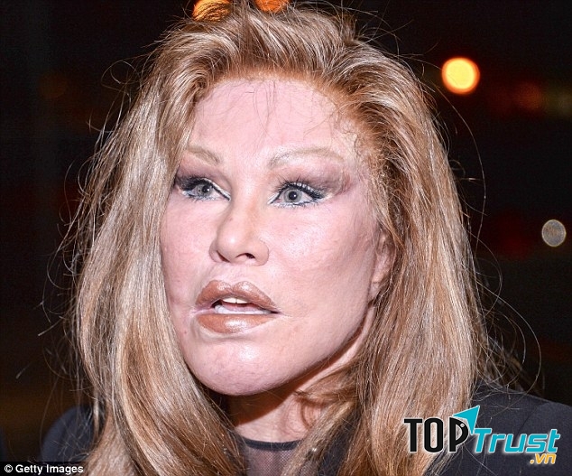 Jocelyn Wildenstein