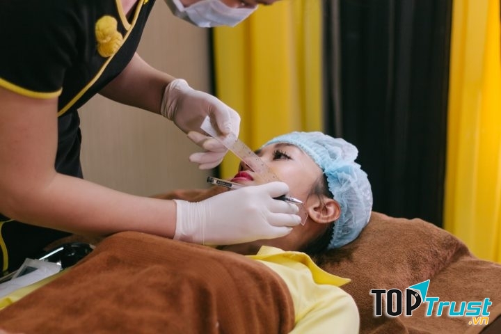 Khách hàng tạo má lúm tại Kay spa