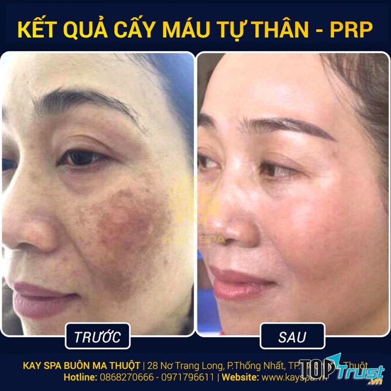 Kay Spa
