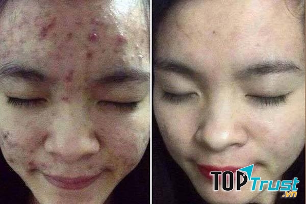 KAY SPA CÀ MAU