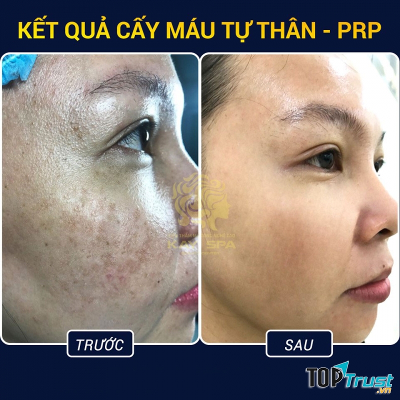 Kay Spa Đà Lạt - Lâm Đồng.