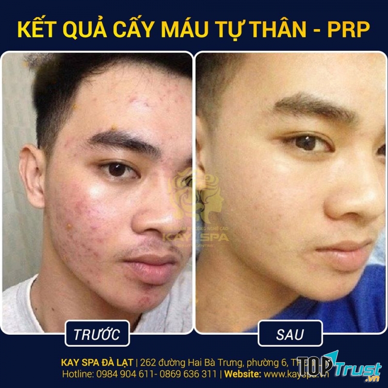 Kay Spa Đà Lạt - Skin Care & Beauty Clinic