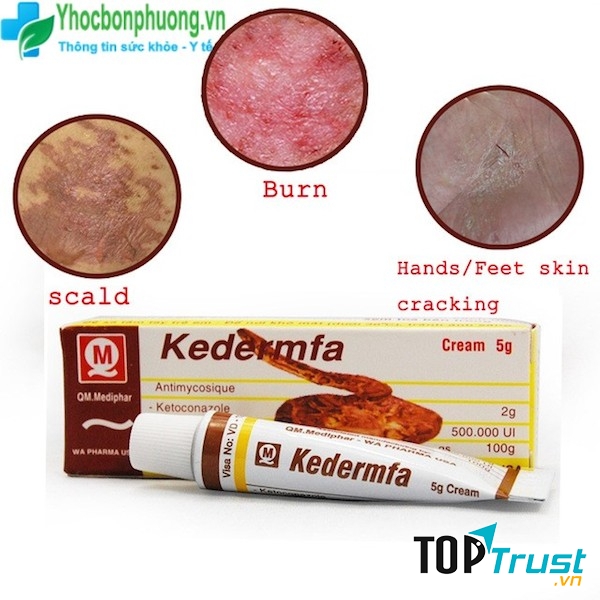 Kem bôi da kedermfa
