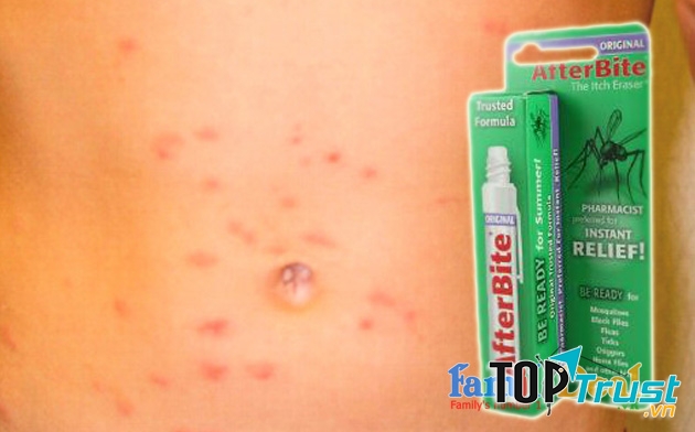 Kem bôi trị côn trùng cắn After Bite USA
